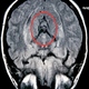 Illustration for article titled Woman Sees Virgin Mary In MRI • Science Says Sugar Is Addictive